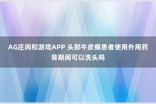 AG庄闲和游戏APP 头部牛皮癣患者使用外用药膏期间可以洗头吗